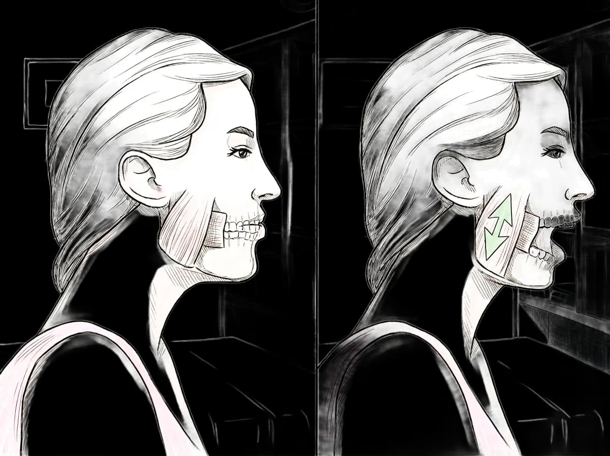 Side profile of a woman in two panels, showing closed and open mouth with muscle and jaw details.